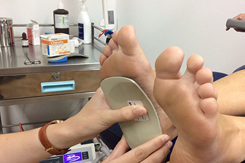 custom foot orthotics